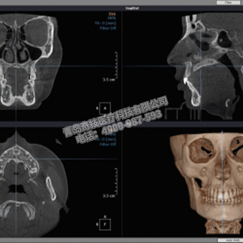 湖北坐式大視野HDX WillDENTRI口腔全景機牙科CBCT維修