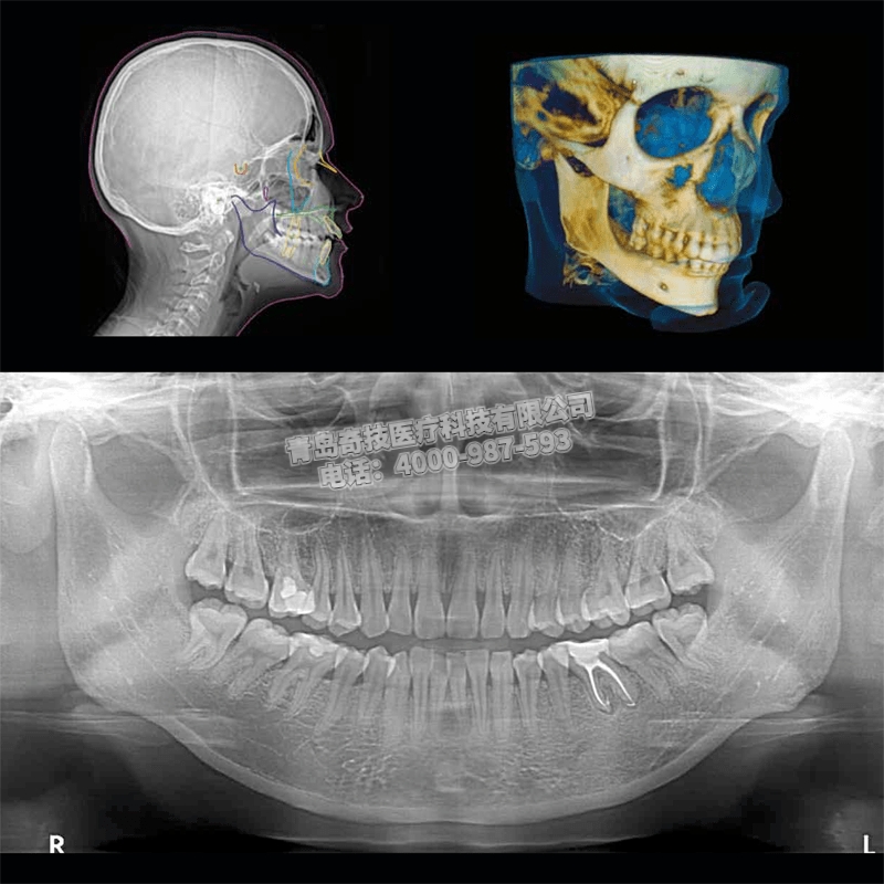 陜西CS9300銳珂口腔全景機二手牙科CT