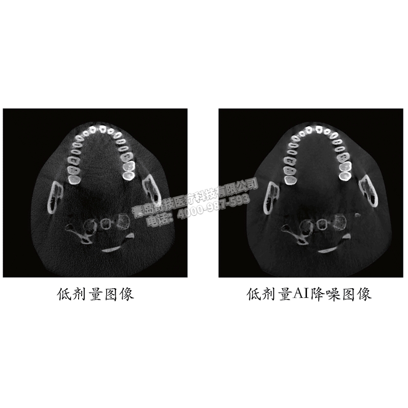 湖北中大視野伯恩登特伯爵M/S口腔全景機牙科CBCT