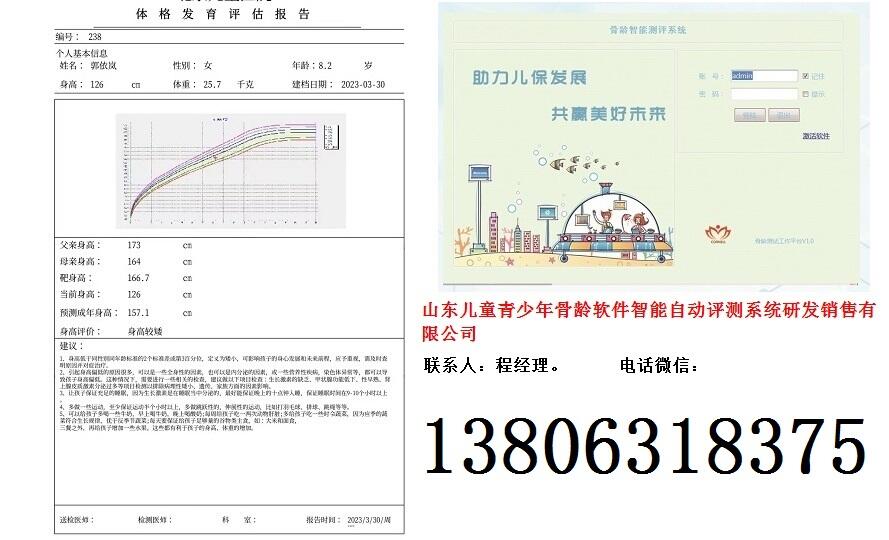 儿童青少年骨龄软件智能自动评测系统