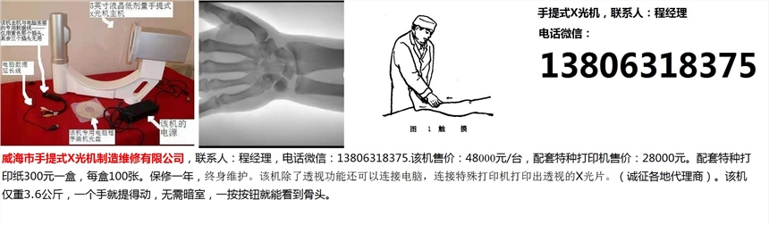 50A型手提式X光机一三八零六三一八三七五程经理