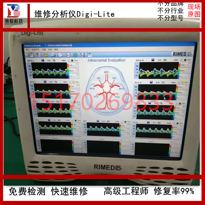 维修超声经颅多普勒血流分析仪 JYQ TCD-2000维修 免费检测博毅