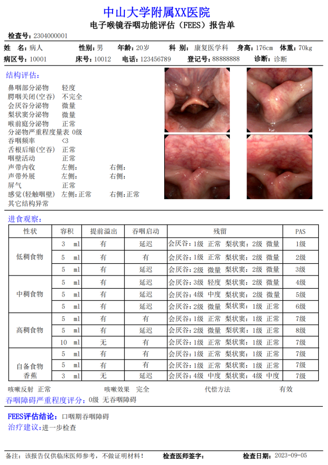 喉镜吞咽评估工作站